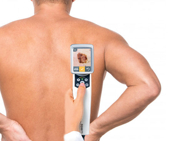 VisioMed D200 evo Canfield Producto Adisat Medical españa