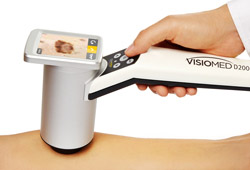 VisioMed D200 evo Canfield Producto Adisat Medical españa