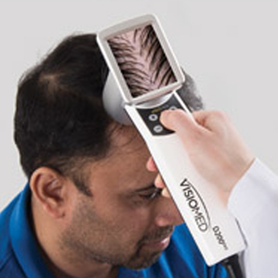 HairMetrix especificaciones Canfield Adisat Medical