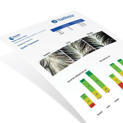HairMetrix especificaciones Canfield Adisat Medical