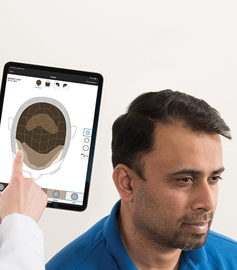 Hairmetrix Canfield Adisat Medical