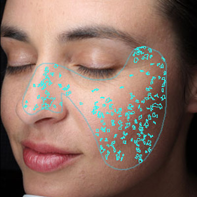 Visia especificaciones Canfield Adisat Medical