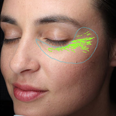 Visia especificaciones Canfield Adisat Medical