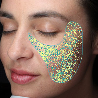 Visia especificaciones Canfield Adisat Medical