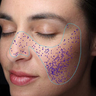 Visia especificaciones Canfield Adisat Medical